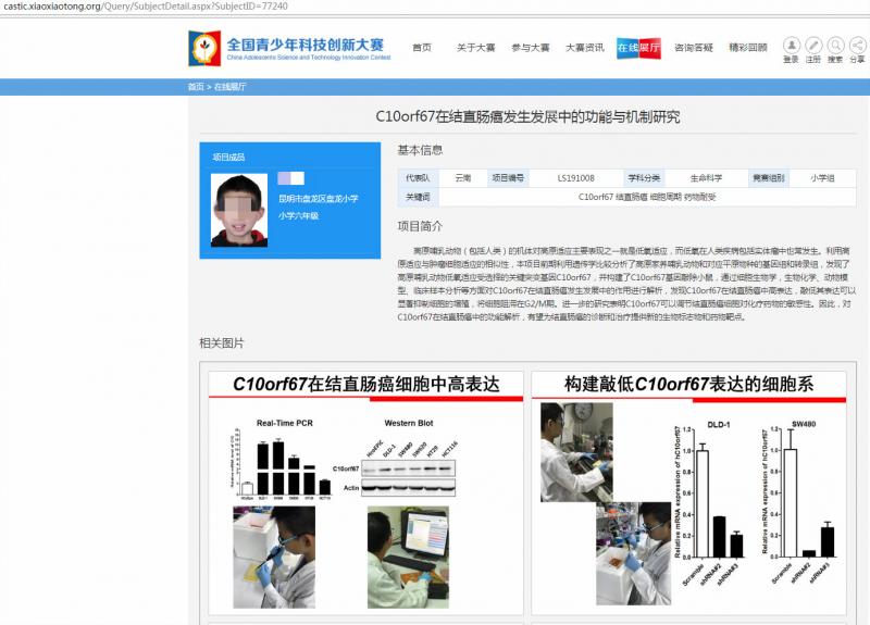 全国青创赛官网显示,陈某某的项目简介称,通过遗传学分析,一种突变基因C10orf67,可以显著抑制细胞的增殖;进一步研究发现,该基因可调节结直肠癌细胞对化疗药物的敏感性。(互联网)